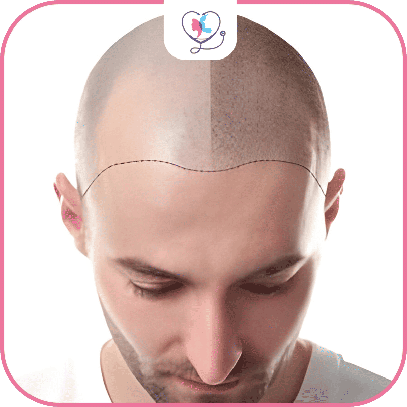 Make the Needed Arrangements for the recovery phase