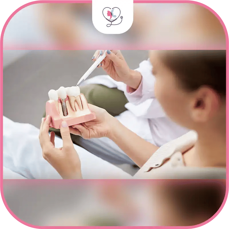 Questions to Ask Before Getting Dental Implants