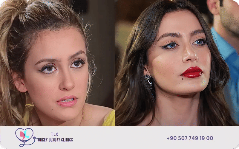 عمليات التجميل التي خضعت لها الفنانة مرام علي