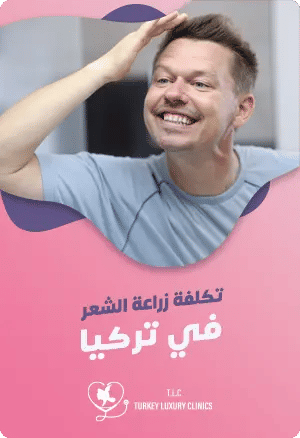 تكلفة زراعة الشعر في تركياfeatured image