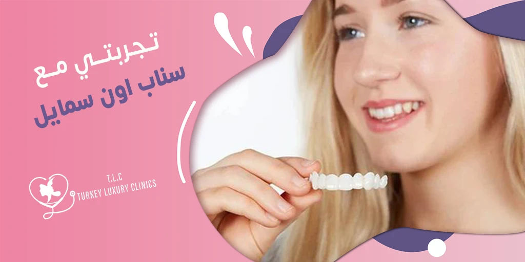 تجربتي مع سناب اون سمايل: المزايا والعيوب وصور حقيقية