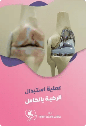 الاستبدال الكلي لمفصل الركبة في تركياfeatured image