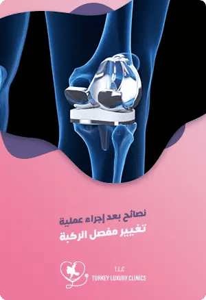 نصائح بعد عملية تغيير مفصل الركبةfeatured image