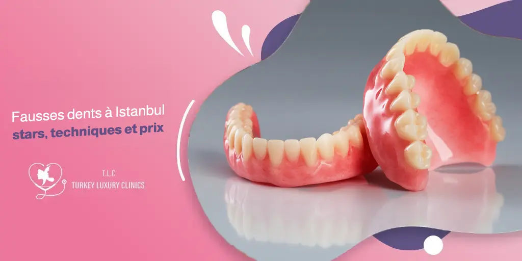 Fausses dents à Istanbul : stars, techniques et prix