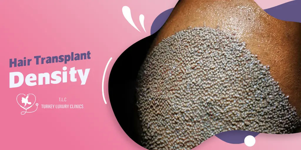 Hair Transplant Density