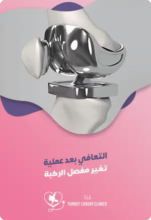 مدة التعافي بعد عملية تغيير مفصل الركبة: مراحل الشفاء كاملةًfeatured image