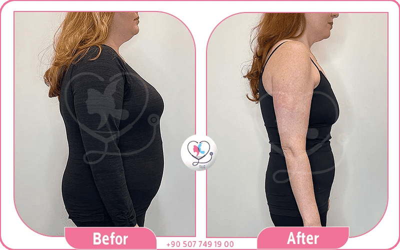 توصيات قبل استخدام ابر اوزمبك توصيات قبل استخدام ابر اوزمبك