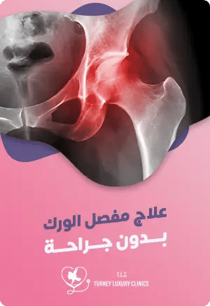 علاج مفصل الورك بدون جراحةfeatured image