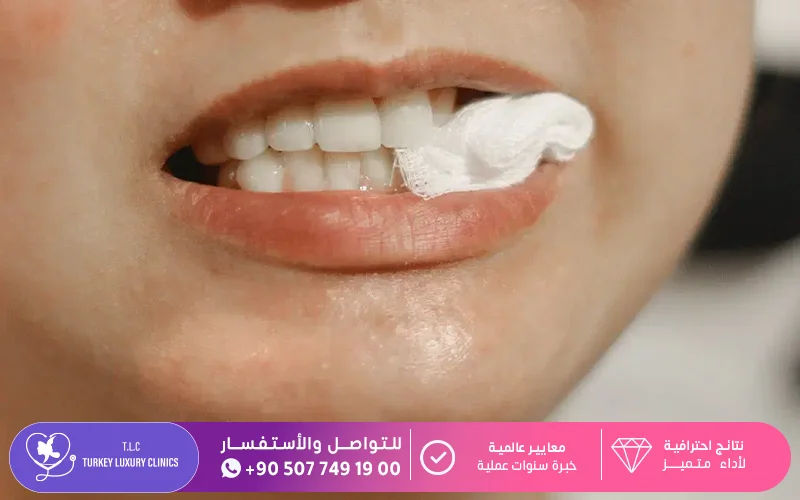 الضغط على مكان النزيف عبر العض على قطعة شاش