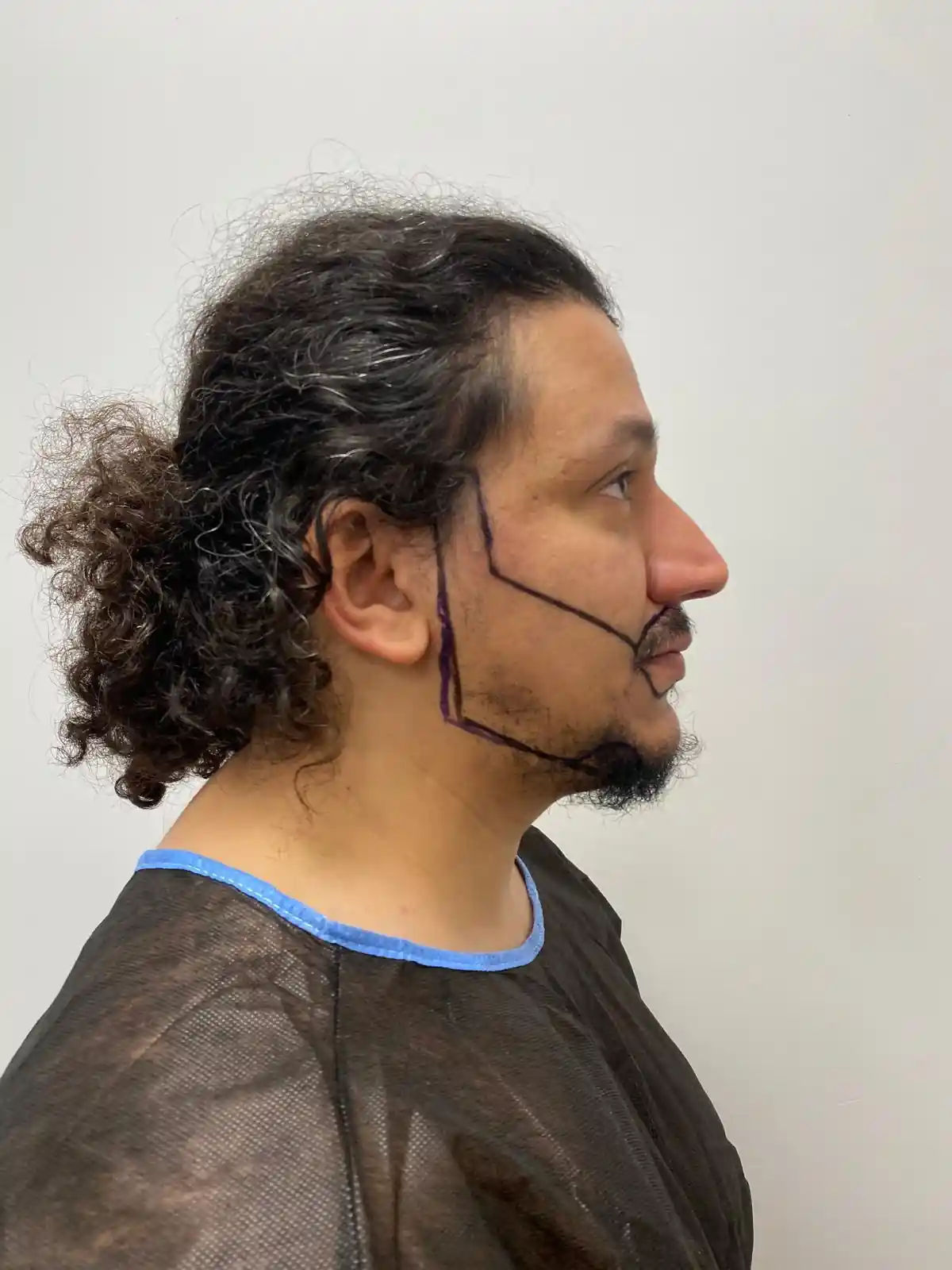 أسباب زراعة اللحية والشارب