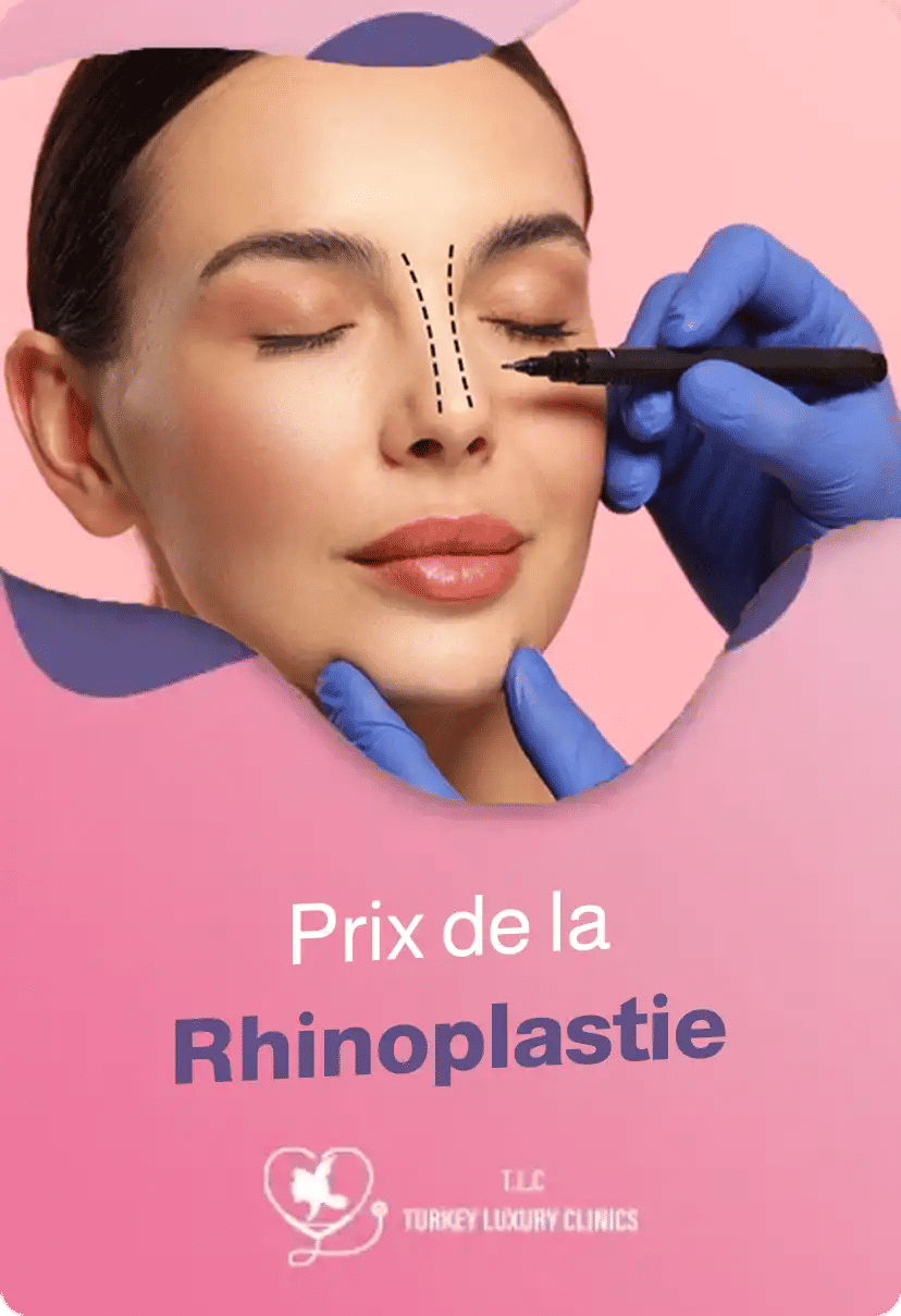 Prix de la Rhinoplastie : Coûts, Comparaisons et Pourquoi Choisir Turkey Luxury Clinic