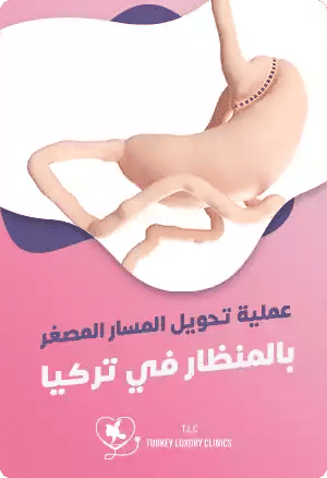 عملية تحويل مسار المعدة المصغر بالمنظار في تركياfeatured image