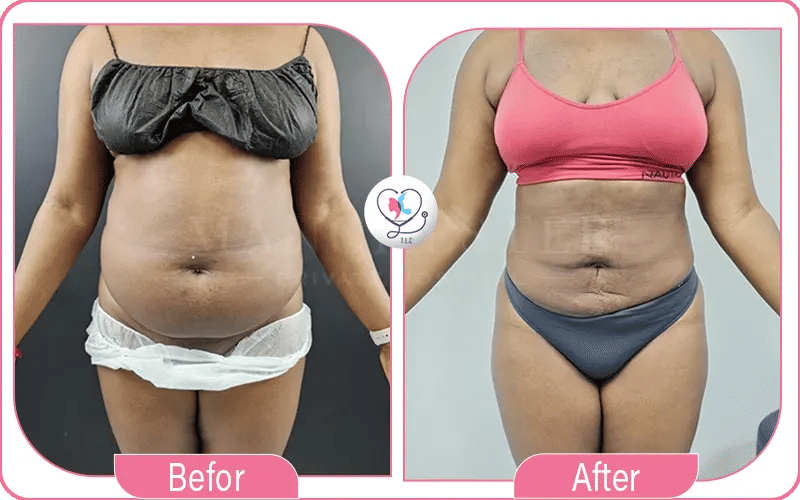 ثالثاً: العملية سريعة وآمنة