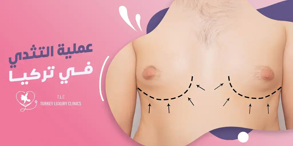 دليل شامل عن عملية التثدي عند الرجال في تركيا