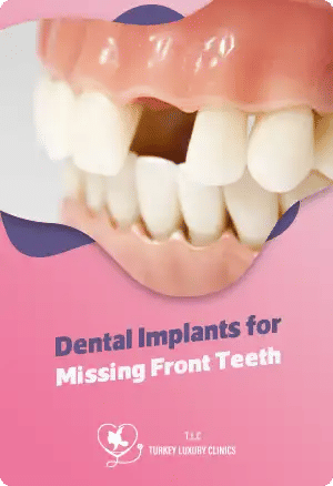 Restore Your Smile: Dental Implants for Missing Front Teeth