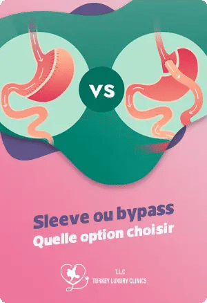 Sleeve ou bypass : Quelle option choisir ?