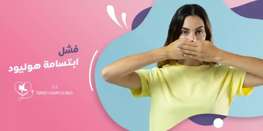 فشل ابتسامة هوليود