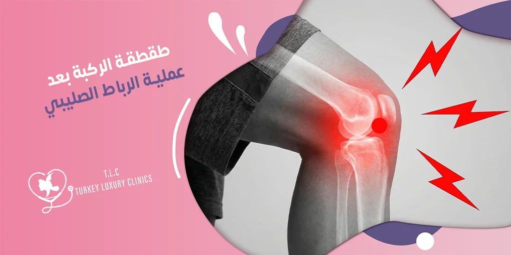 طقطقة الركبة بعد عملية الرباط الصليبي: الأسباب والوقاية