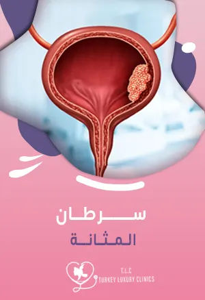 سرطان المثانة: العلامات المبكرة وخيارات العلاج