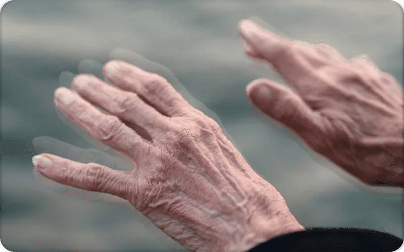 Which Symptoms Improve Longest with Deep Brain Stimulation?