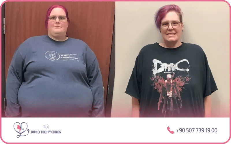 Perte de poids durable