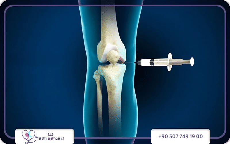 العوامل التي تؤثر على أسعار أنواع حقن الركبة