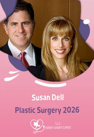 Susan Dell Plastic Surgery 2026: Before & After, Expert Analysisfeatured image