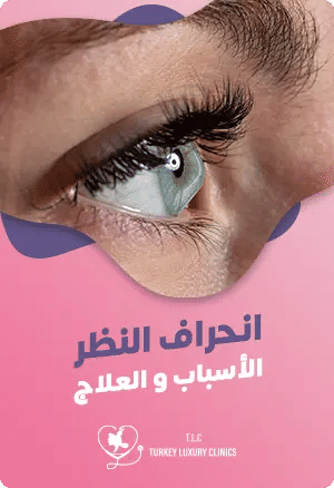 انحراف النظر: الأسباب، الأعراض والعلاجfeatured image