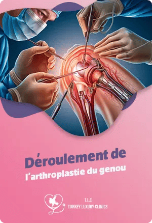 Déroulement de l'arthroplastie du genou : Étape par étapefeatured image
