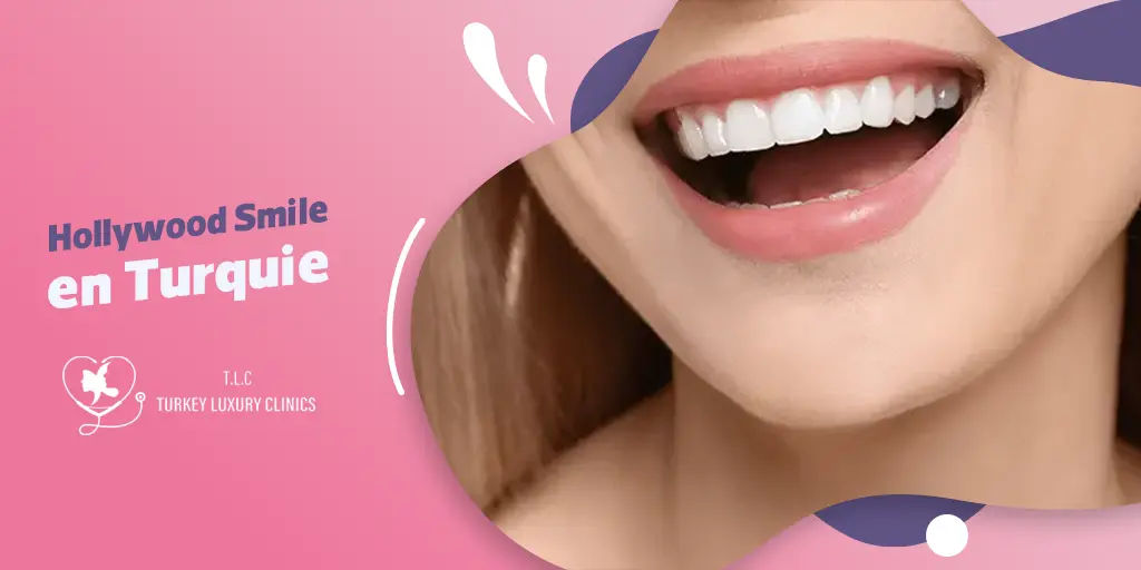 Hollywood Smile en Turquie