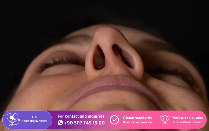 Who Is the Ideal Candidate for Septoplasty?