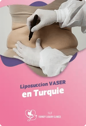 Liposuccion VASER en Turquie