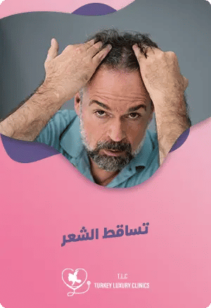 كيفية علاج تساقط الشعر في تركياfeatured image