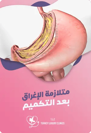 متلازمة الإغراق بعد التكميمfeatured image