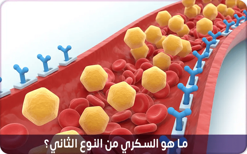 ماهو السكري من النوع الثاني؟