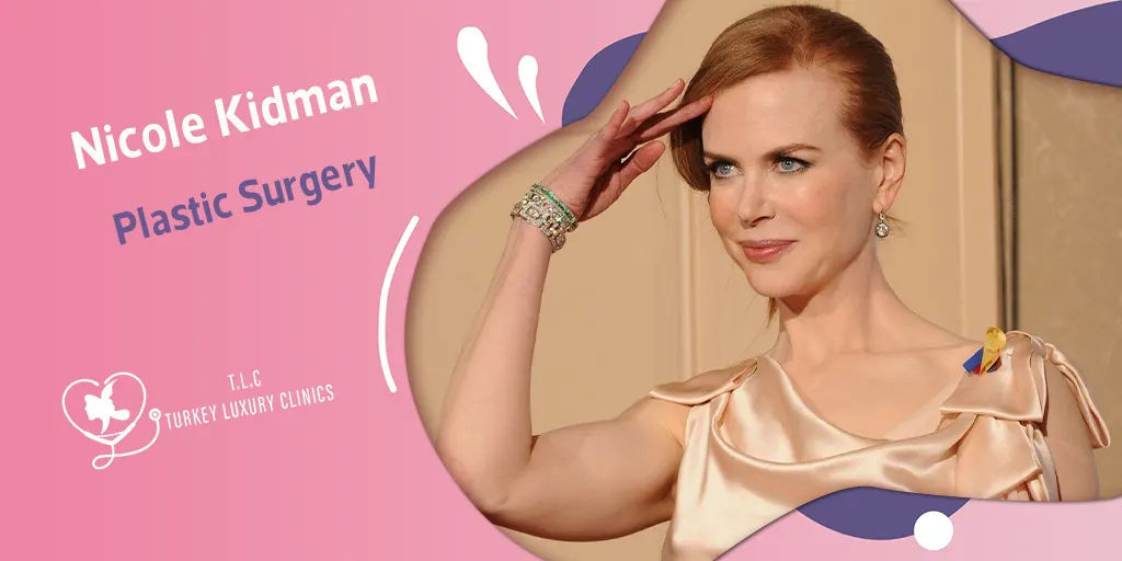 Chirurgia plastica Nicole Kidman: voci e verità