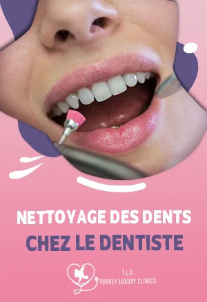 Nettoyage des dents chez le dentiste : Guide complet