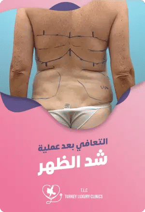 التعافي بعد عملية شد الظهر: الجدول الزمني والنتائج المتوقعةfeatured image