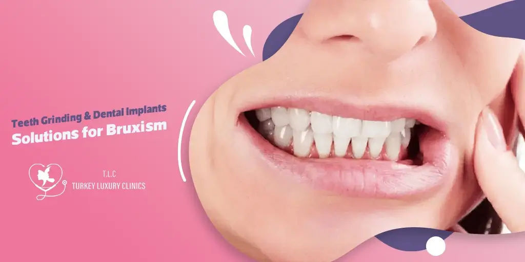 Zähneknirschen & Zahnimplantate: Lösungen für Bruxismus