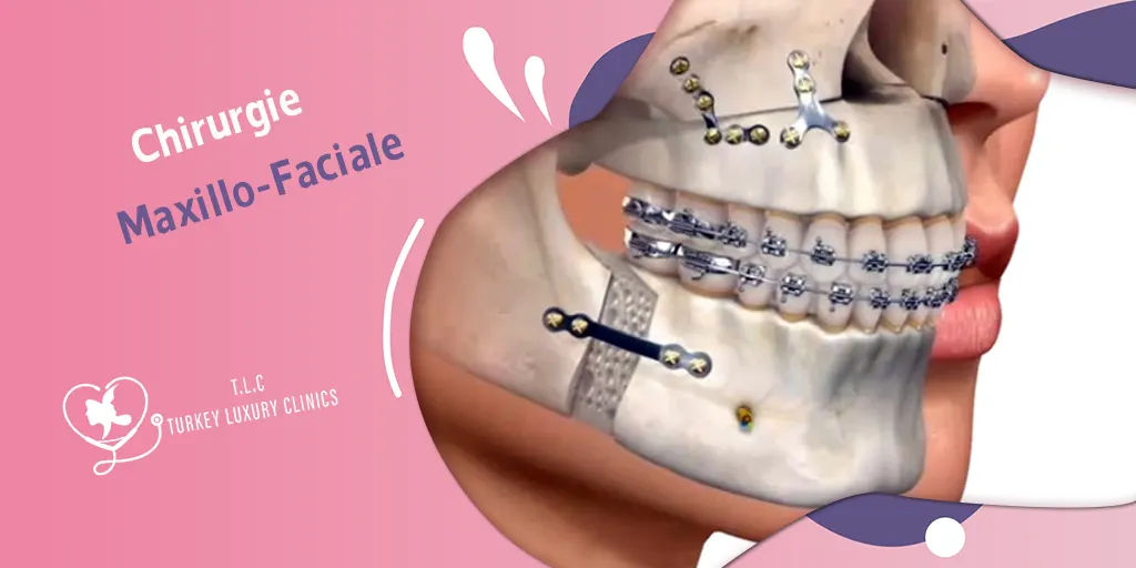 Chirurgie Maxillo-Faciale: traitements, interventions et avantages