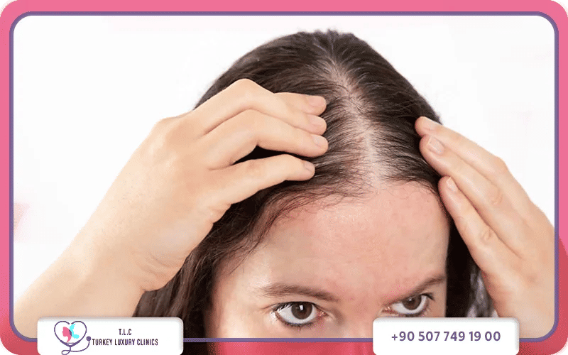علاج فراغات الشعر مع تركيا لاكشري كلينك
