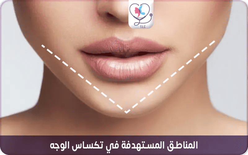 المناطق المستهدفة في تكساس الوجه