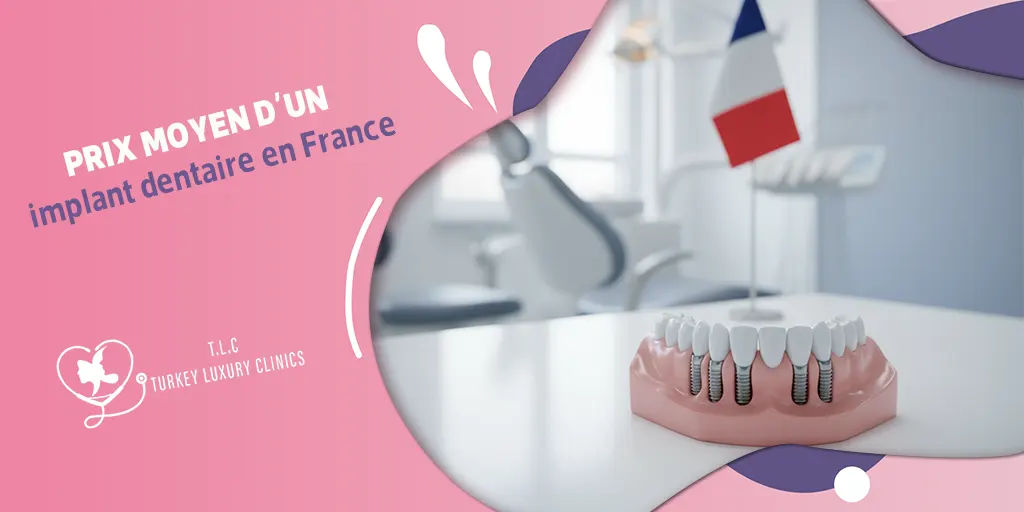 Prix moyen d’un implant dentaire en France:prix, remboursement