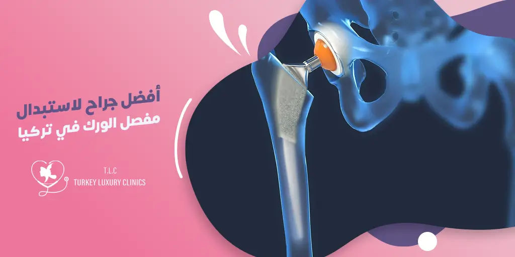 أفضل جراح لاستبدال مفصل الورك في تركيا