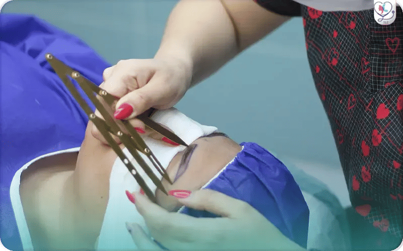 Cost of Eyebrow Hair Transplant 2026