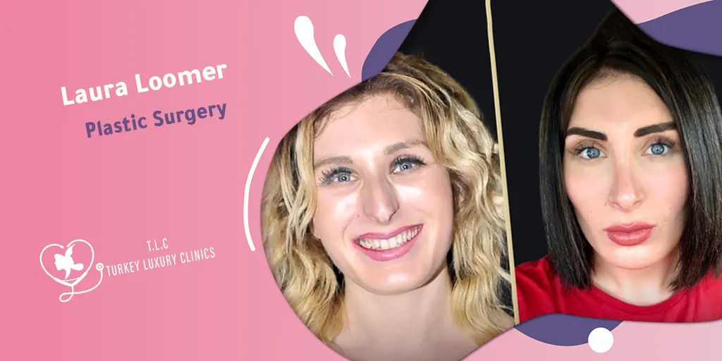 Laura Loomer Schönheitschirurgie: Nasenoperation und Lippenvergrößerung