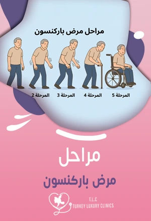 مراحل مرض باركنسون: 5 مراحل يجب أن تعرفها لتسيطر عليها