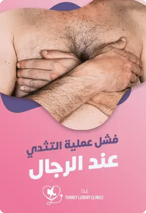 فشل عملية التثدي عند الرجالfeatured image