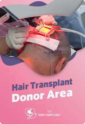 Hair Transplant Donor Area