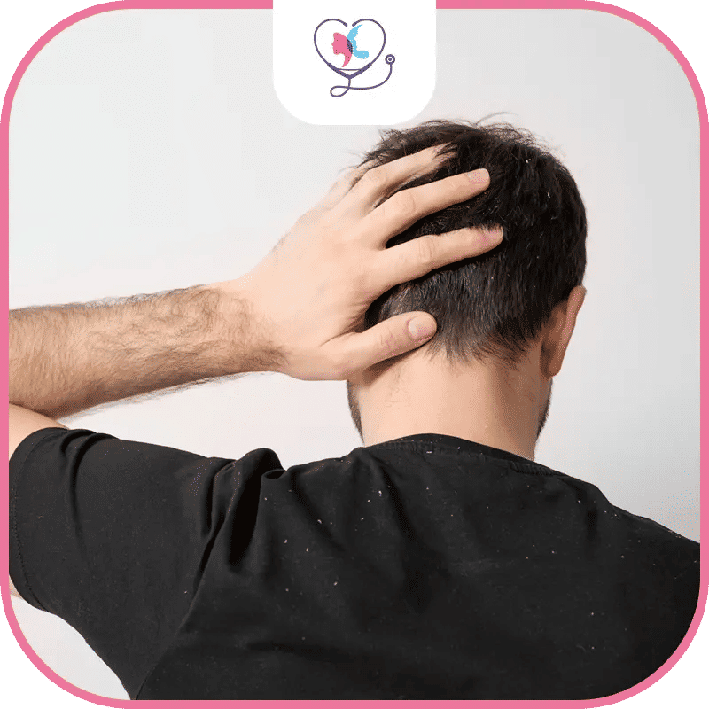 complications psychologiques d'une greffe de cheveux ratée